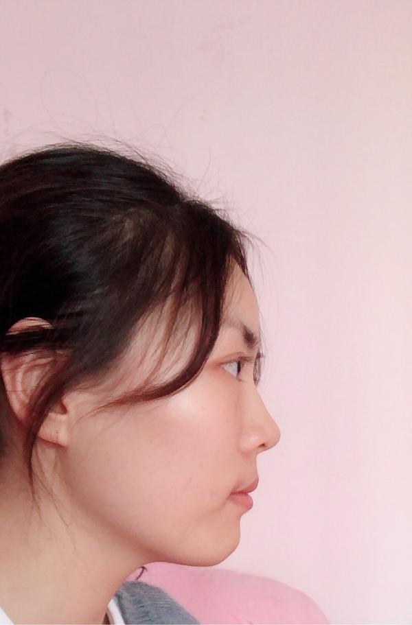 正脸好看但侧脸丑到爆是种怎样的体验?