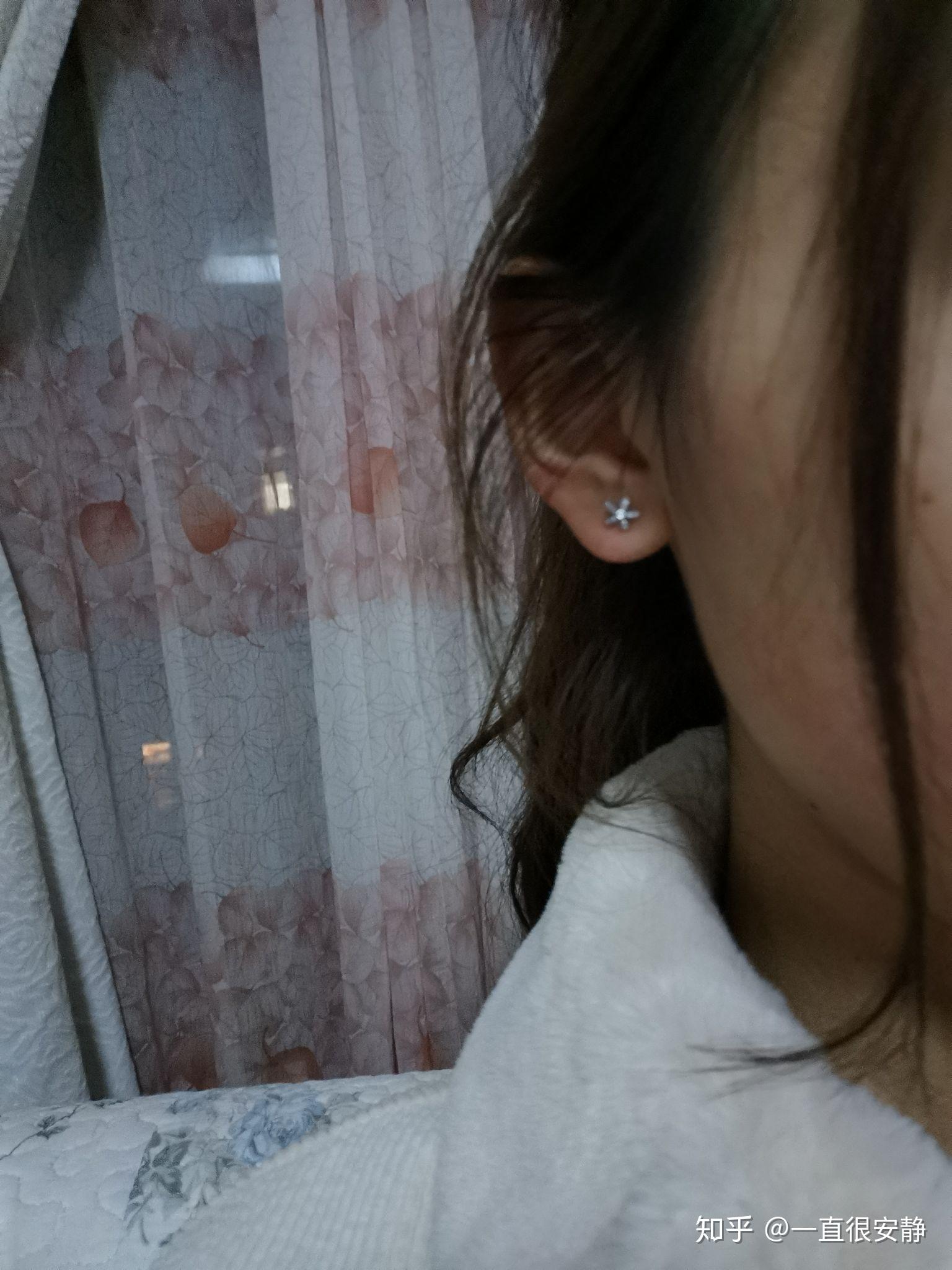 怎么会有愈合不了的耳洞