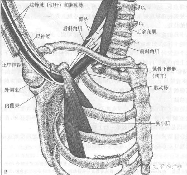 的关系 其实从解剖上来看,胸小肌的深层有着臂丛神经,腋动脉和腋静脉