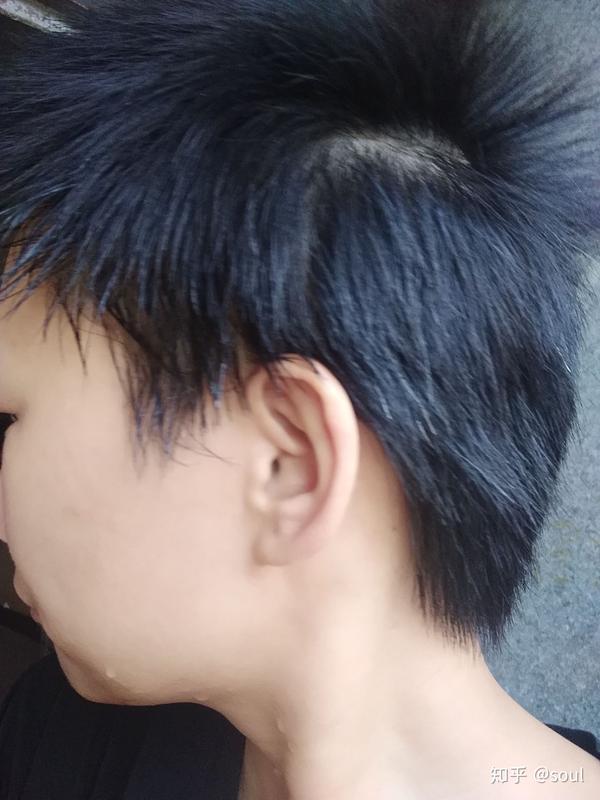 头发硬且多,往上长的男同胞们你们剪着怎样的发型?