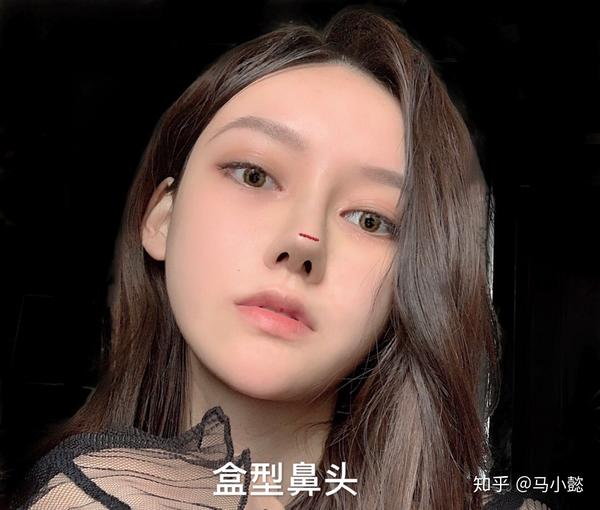 浓颜系隆鼻审美混血鼻的关键所在盒鼻