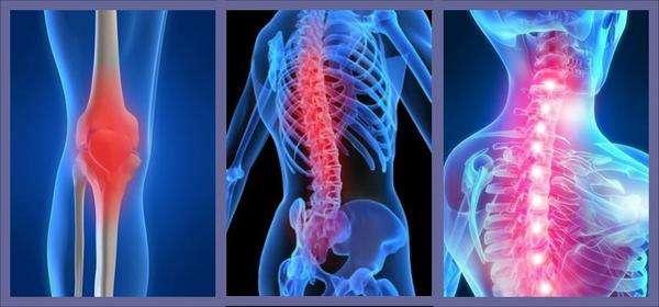 什么是骶髂骨关节炎,它和强直性脊柱炎的区别有哪些?