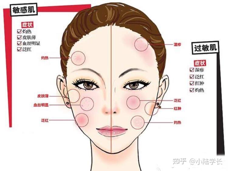 敏感肌皮肤薄能做光子嫩肤吗做完会加重