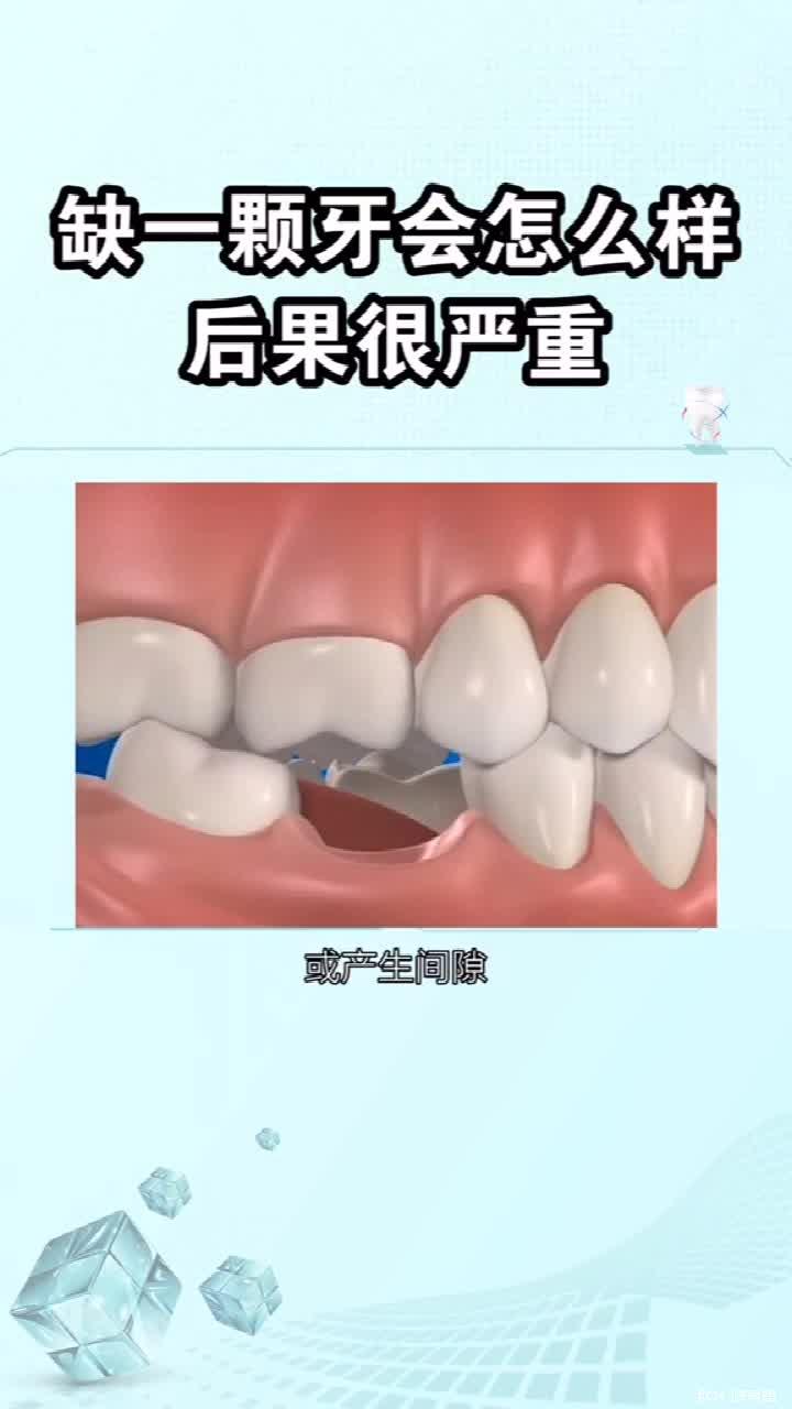 缺牙两年后牙槽骨会不会被吸收