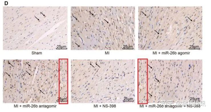 tunel染色分析小鼠心肌细胞的凋亡,fig4d不同分组间存在图片重复使用