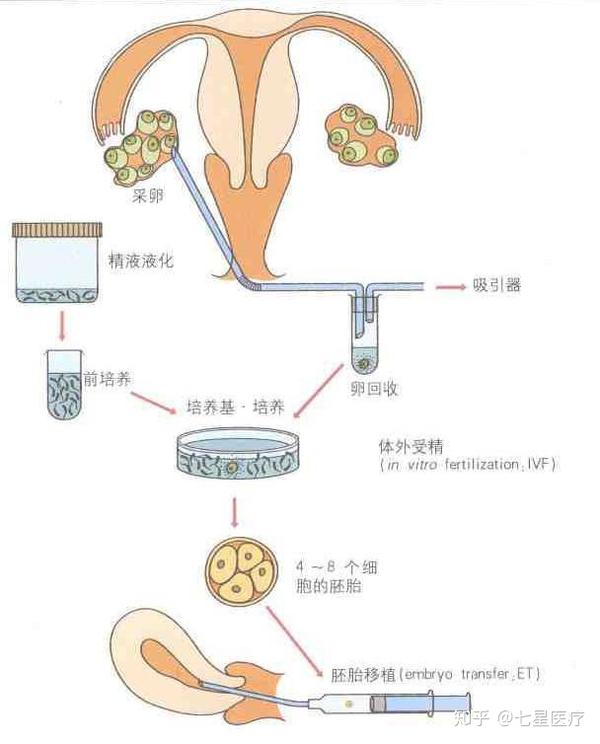 促排卵