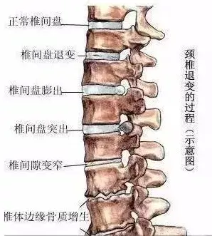 颈腰椎说今天你爱搭不理我明天让你不能自已