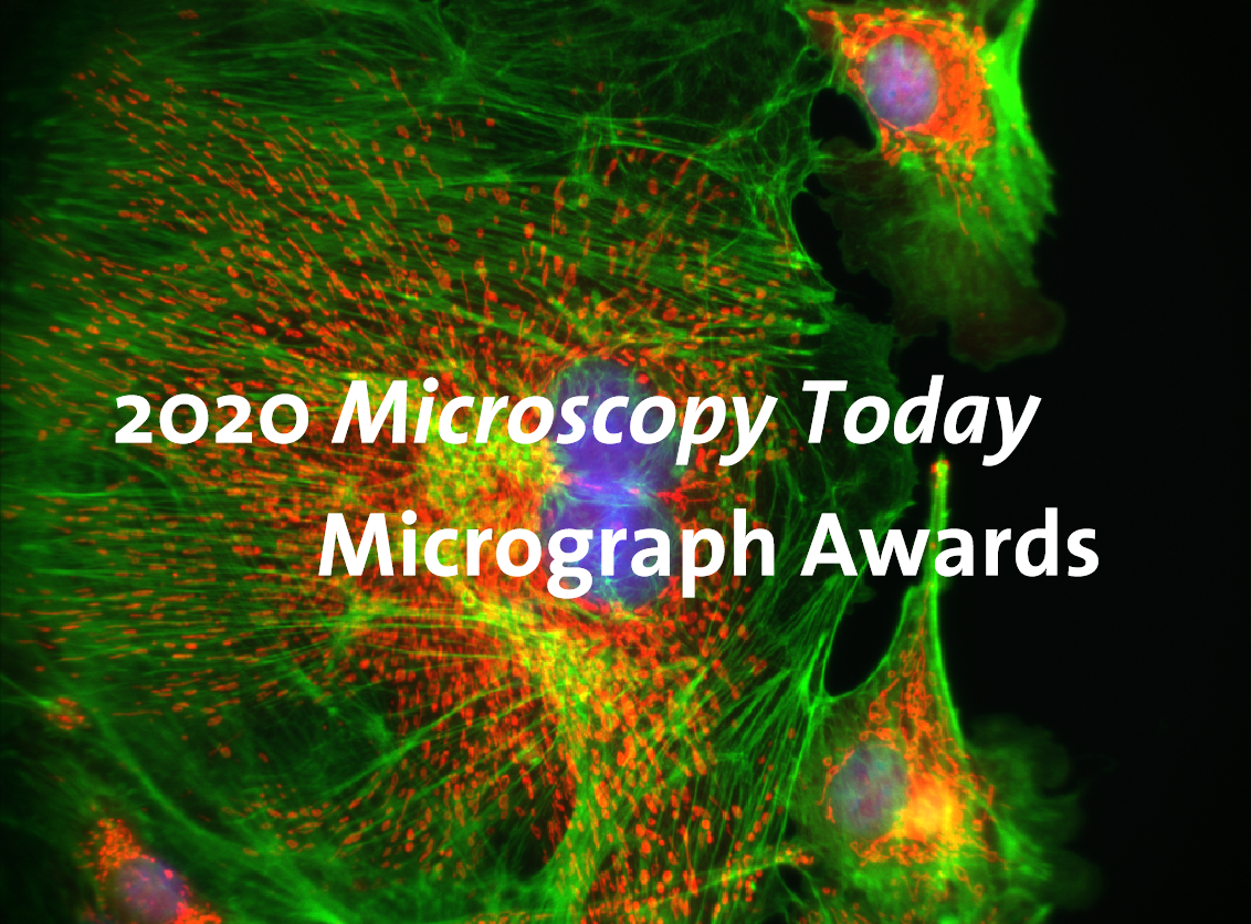 witec拉曼-宽场荧光成像荣获microscopy today micrograph award