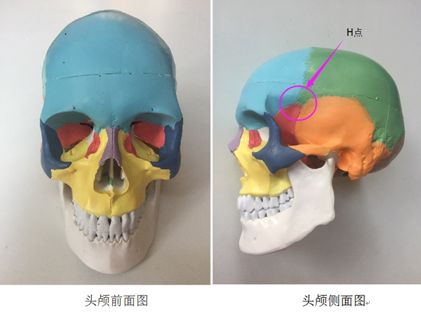 头颅骨与面部衰老之间的秘密