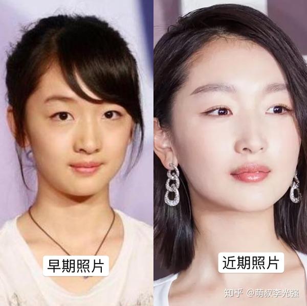 从《山楂树》到《少年的你》,周冬雨的肿泡眼下垂眼反成个人特色?