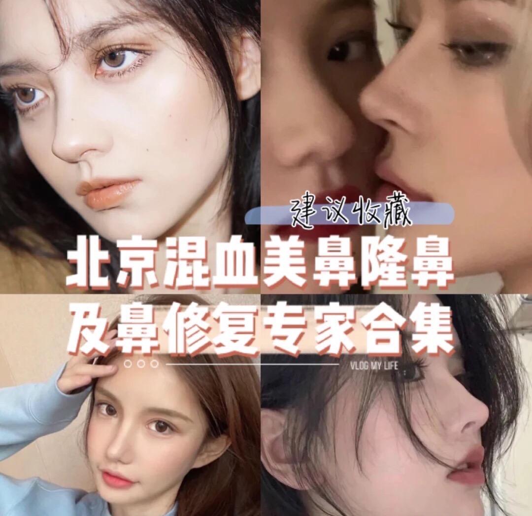 北京混血夸张网红隆鼻鼻修复的专家医生盘点