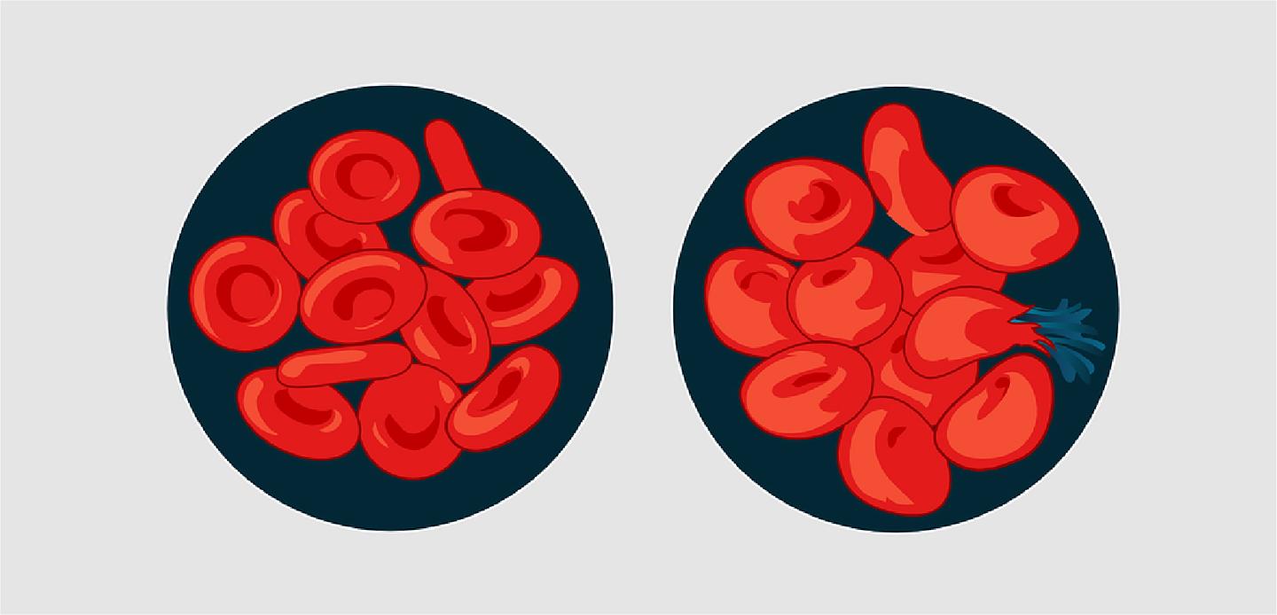 今天教大家如何绘制卡通版和仿真版的红细胞