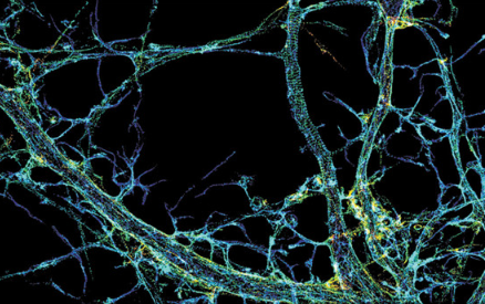 microscopy,storm),科学家首次观察到了神经元轴突的细胞骨架