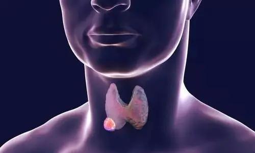 涨见识甲状腺结节和甲状腺癌筛查攻略