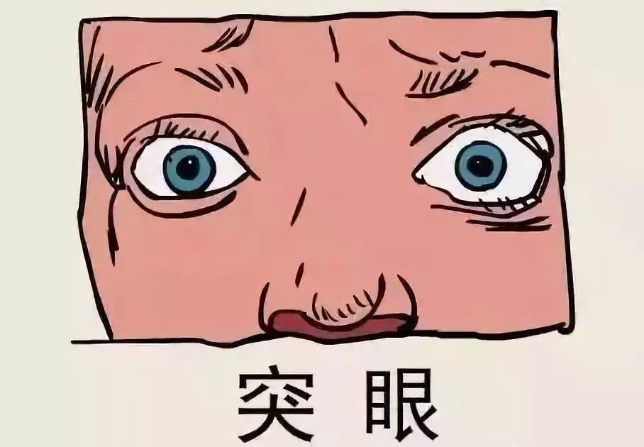 甲亢突眼分为4个等级你都知道吗
