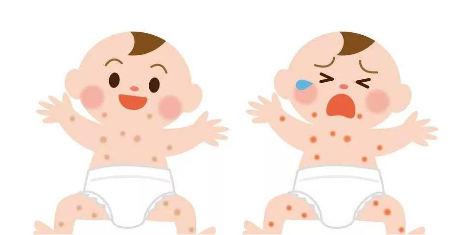 宝宝湿疹反复发作该怎么办呢