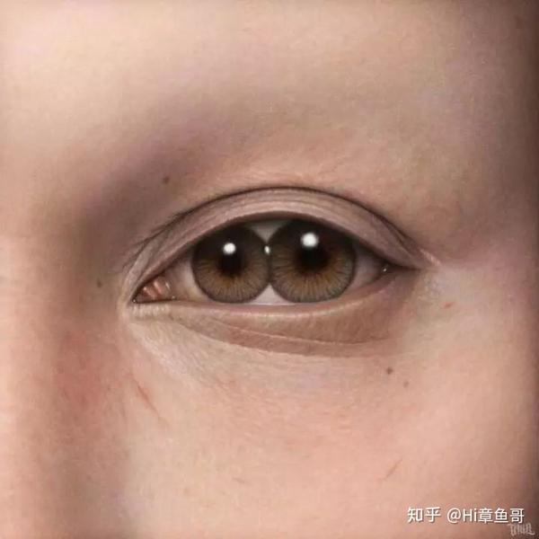 最近有人问世界上究竟有没有眼生"双瞳"的人 ?