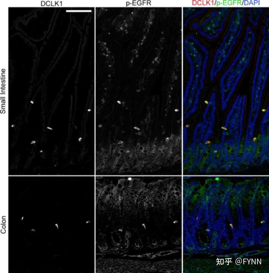 图2小鼠小肠和结肠p-egfr染色图3小鼠组织中hopx抗体的验证图3小鼠