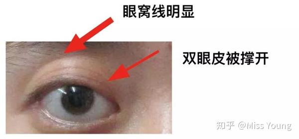 能否请各位老师指导一下高度近视眼球外凸的眼妆画法?