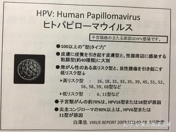 hpv(人乳头瘤病毒)病毒有100种以上