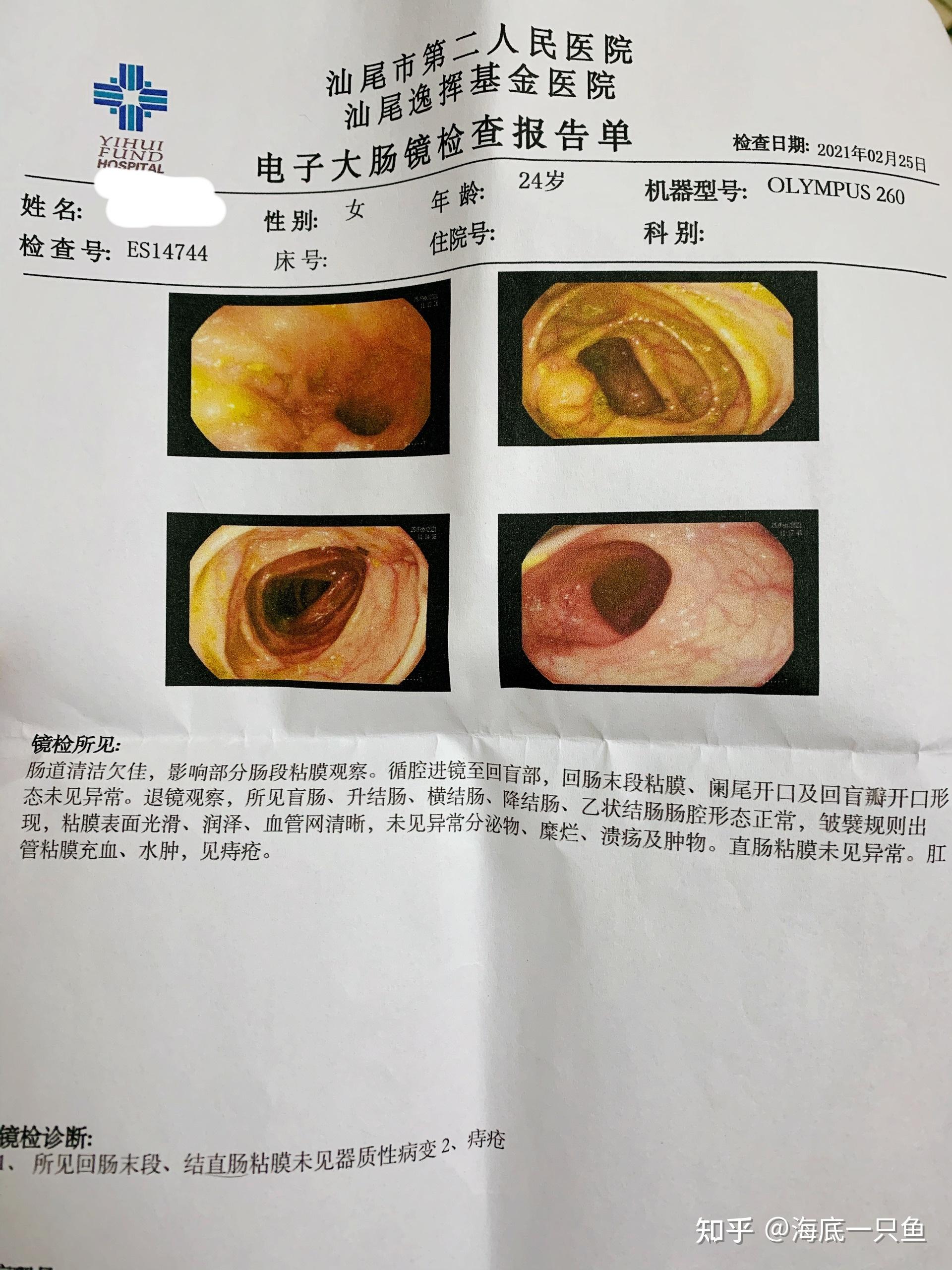 胃胀腹胀,做胃镜真的很痛吗?