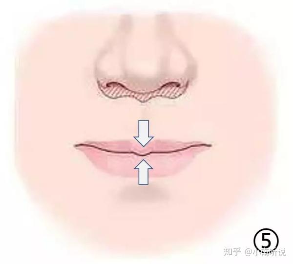 【家长课堂】唇运动障碍及其10种训练方法