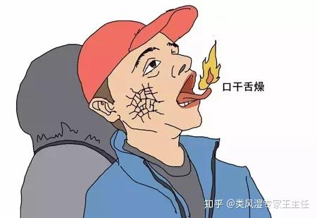 中老年女性如何预防干燥综合征?