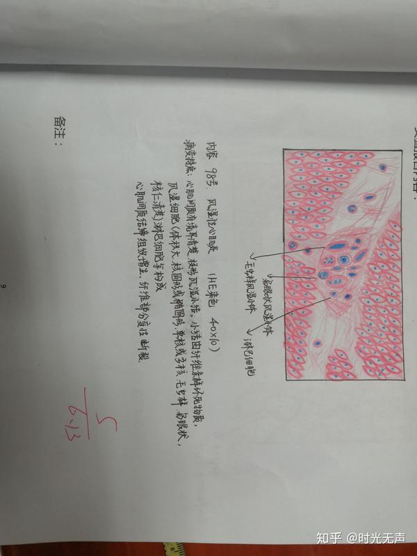 这学期病理手绘图老师总给5我被宫颈原位癌难到了