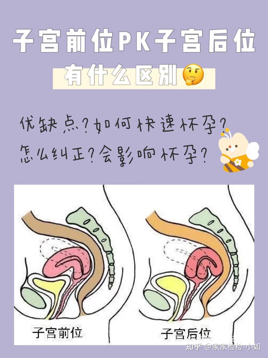 子宫前位怎么怀孕?