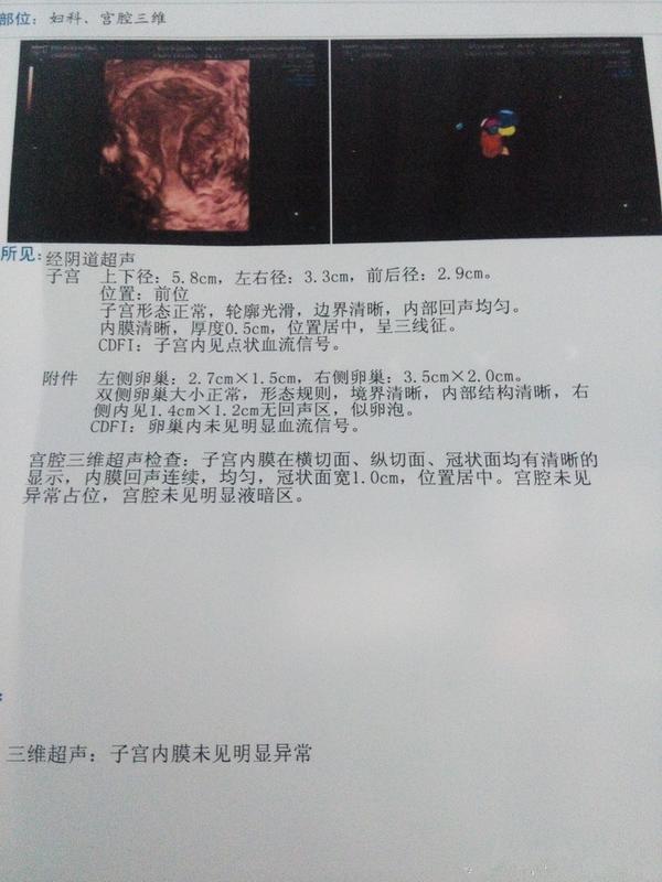 宫腔粘连怎么办呢?可以治好吗?