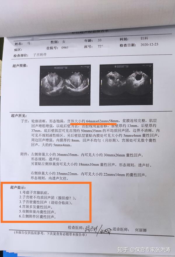 7年的腺肌症,诊刮 宫腹腔镜探查术 曼月乐环,一路曲折