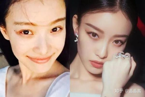 鼻子对五官整体效果是怎样?隆鼻真的有必要吗?