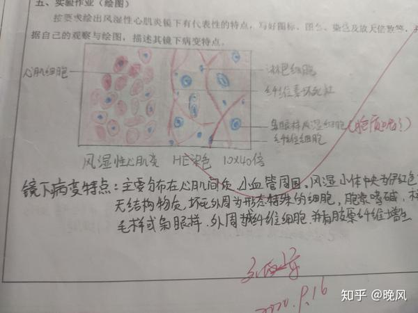 病理学红蓝绘图