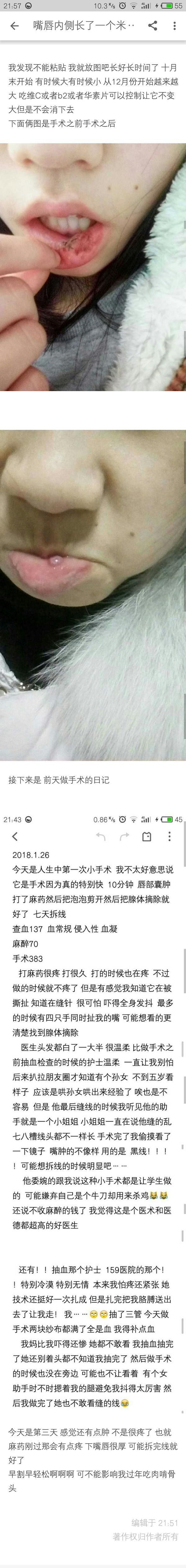 我的泡泡到后来都变成红色了 越长越大 唇腺囊肿 去了好多医院都说