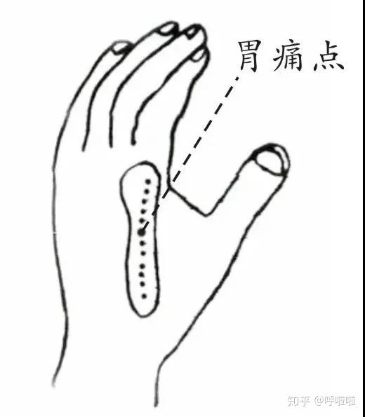 突然胃疼怎么办