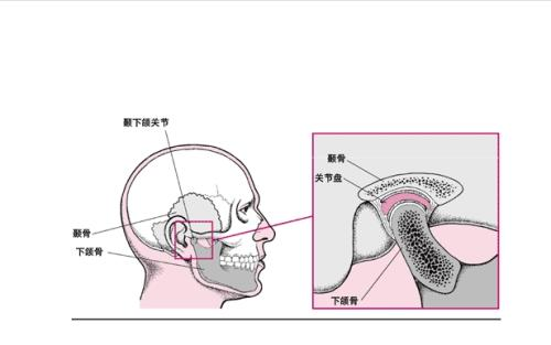 髁突磨损为什么会导致牙齿开颌