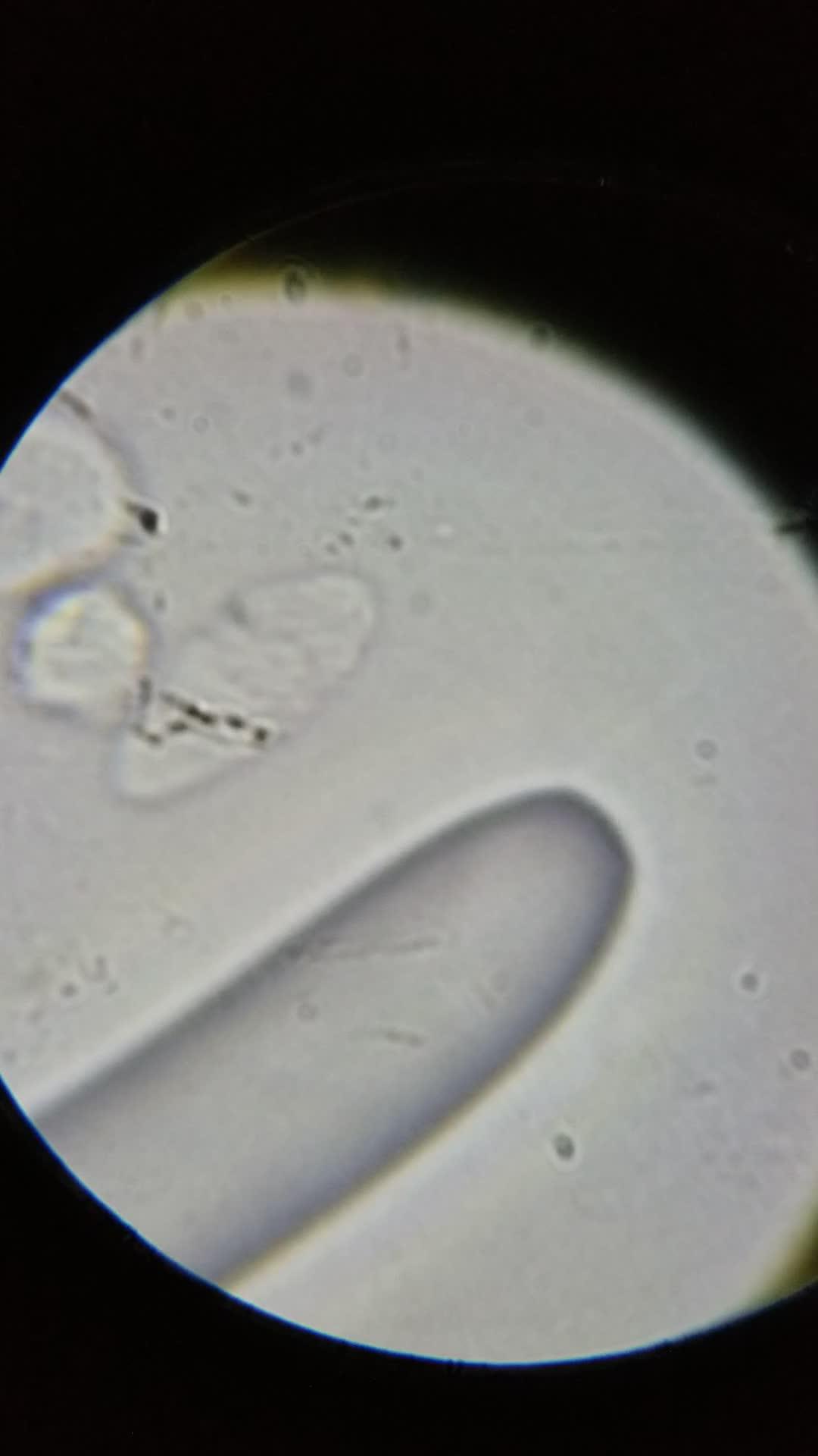 鼻涕在显微镜下观察到的这两个微生物是什么?