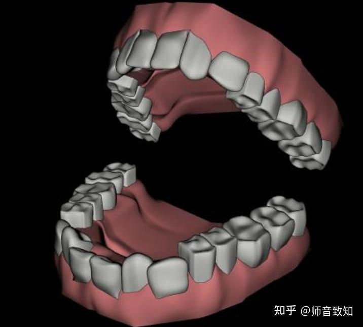 打开牙关和张大嘴的区别是啥