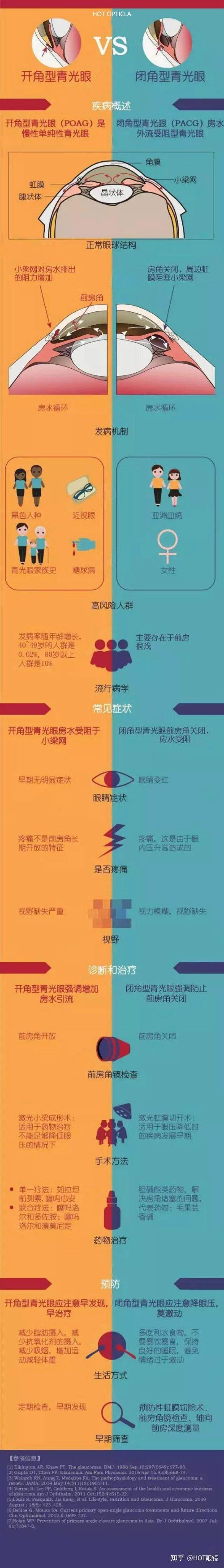 开角型青光眼vs闭角型青光眼