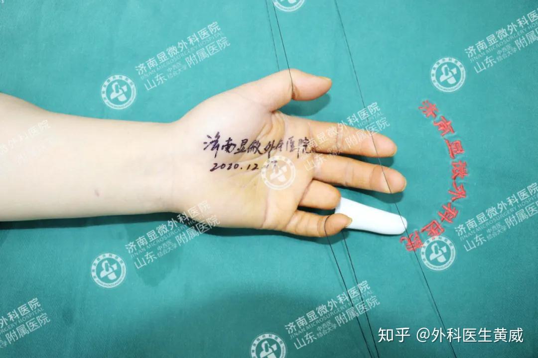 断指重生医生奋战11小时再造手指只为守住患者生活的希望