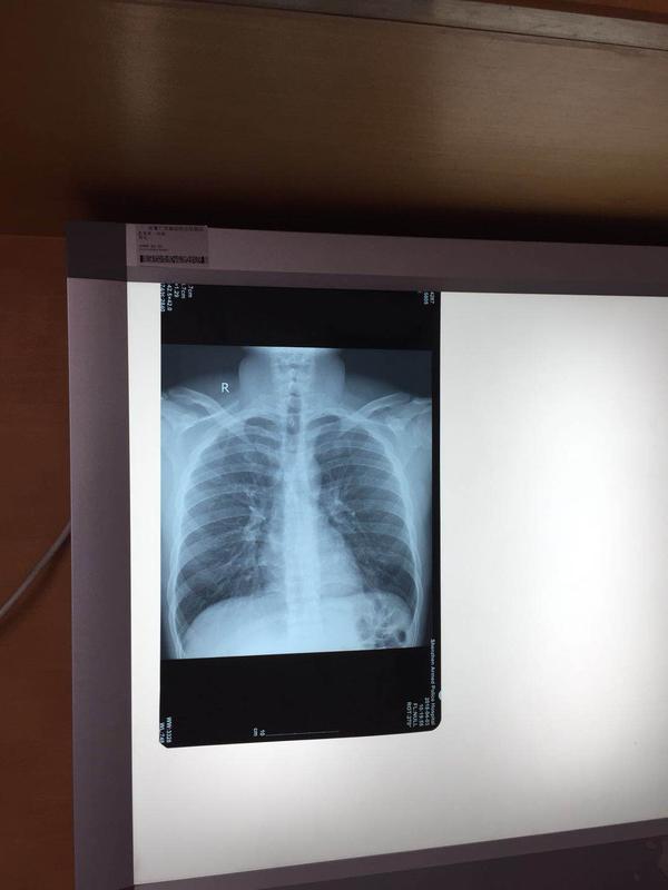 紧遵医嘱,医生让你打针就打针,别以为自己比医生聪明,而且一定要拍片.