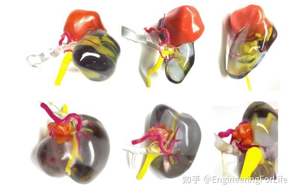 医用器官模型的3d打印