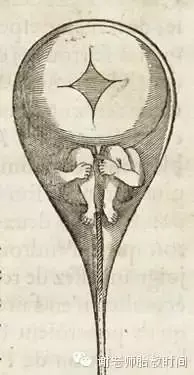 5,孕妇子宫解剖图(1774年)