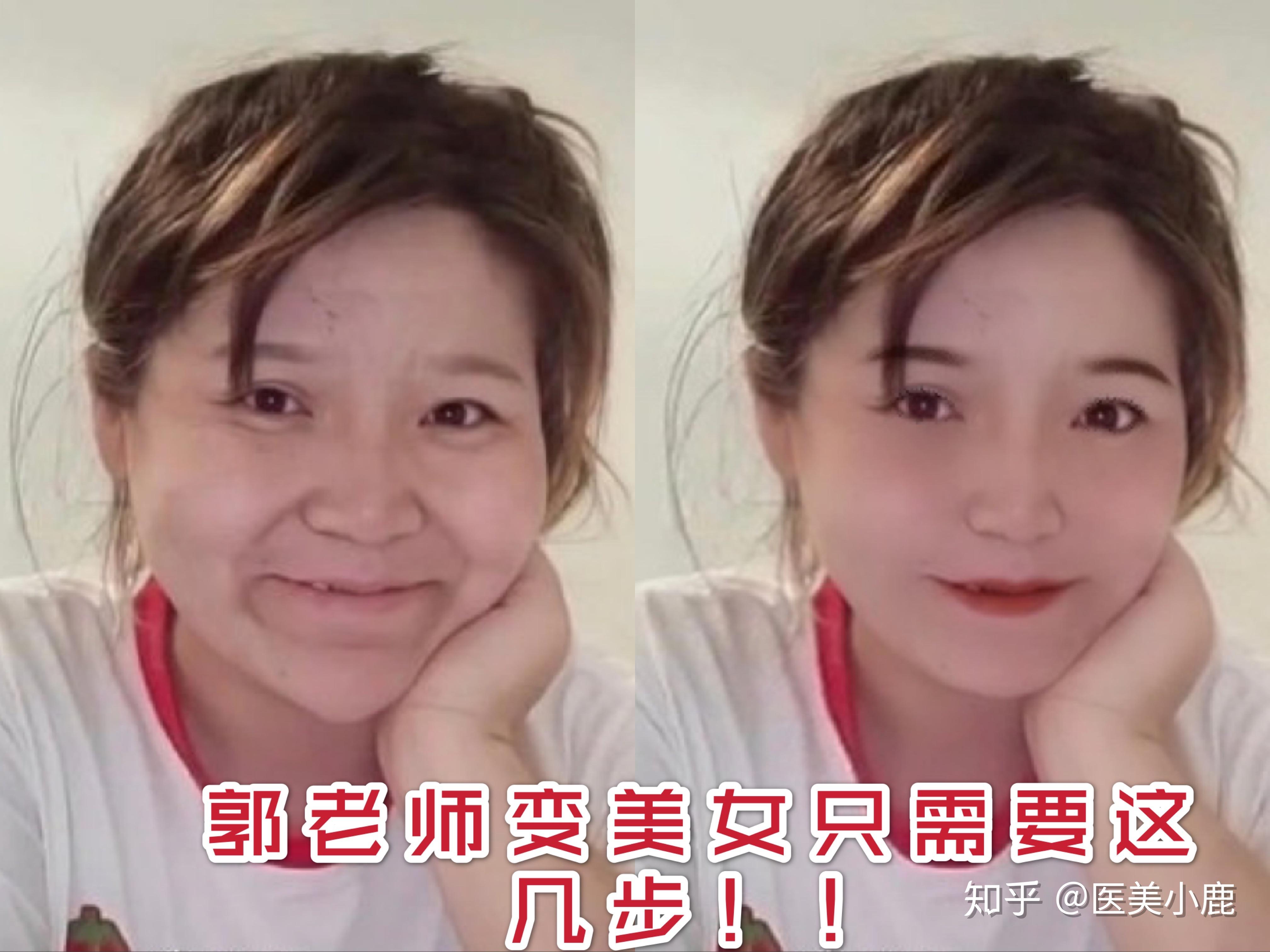 只要调整这几个地方郭老师也能变成大美人