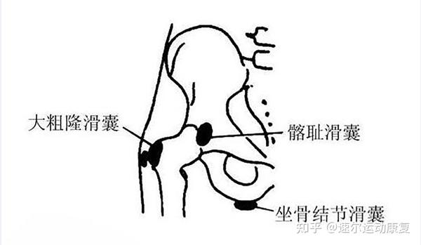 滑囊除了能帮助我们润滑髋关节活动之外,还可以起到一个缓冲震荡和