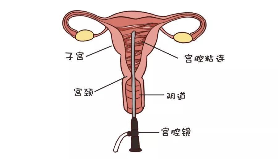 产后正常范围宫腔分离是多少?现在贝安健康晓晓带着大家一起了解.