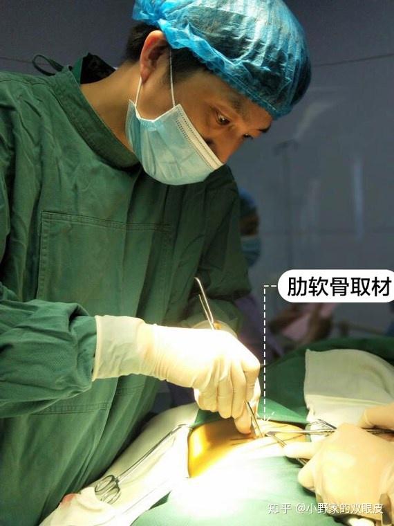 肋软骨钙化是什么?还可以做鼻综合吗?