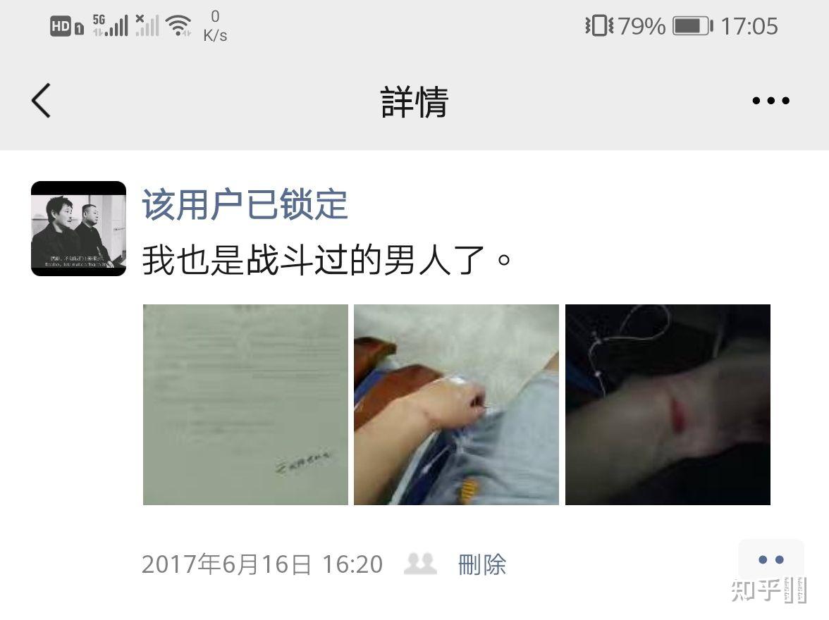 注射完全部狂犬疫苗后多久可以喝酒