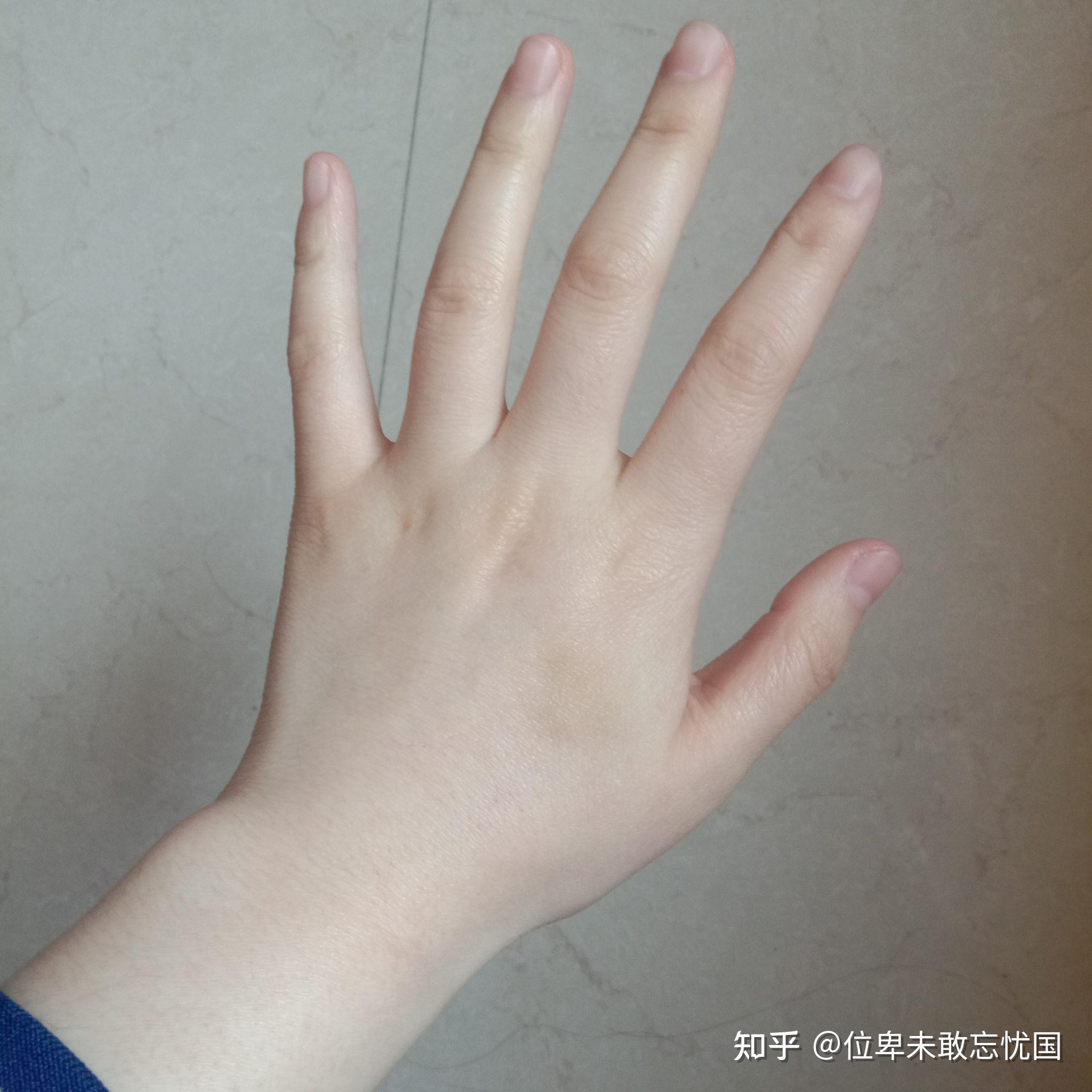 女孩子长了一双特别难看的手是什么感觉