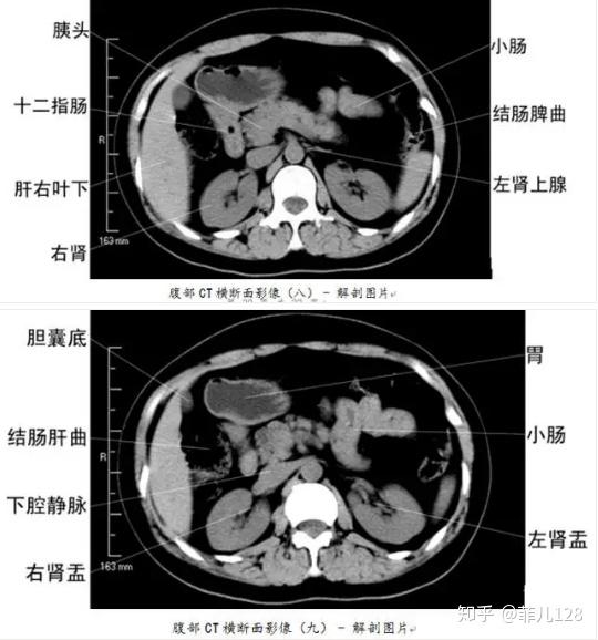 全身ct图谱赶紧收藏了吧